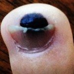 DM_toe_120831